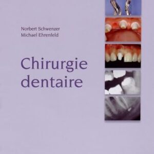 Chirurgie Dentaire