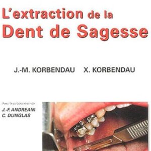 L'extraction de la dent de sagesse