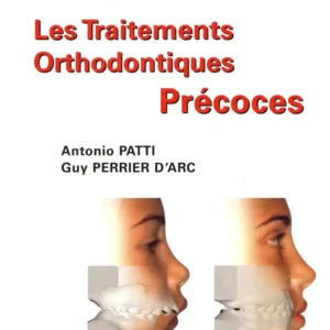 Les traitements orthodontiques précoces