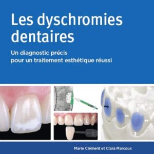 Les dyschromies dentaires