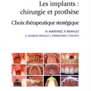 Les implants : chirurgie et prothèse : Choix thérapeutique et stratégique