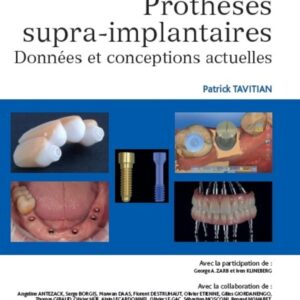 Prothèses supra-implantaires: Données et conceptions actuelles