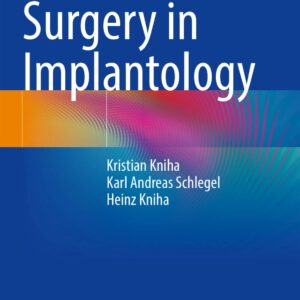 Guided Surgery in Implantology