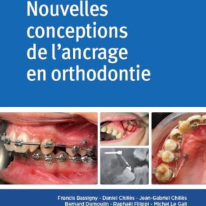 Nouvelles conceptions de l'ancrage en orthodontie