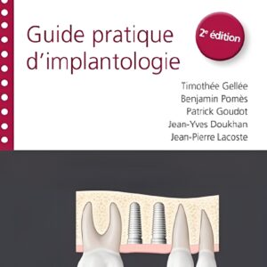Guide pratique d'implantologie 2e édition