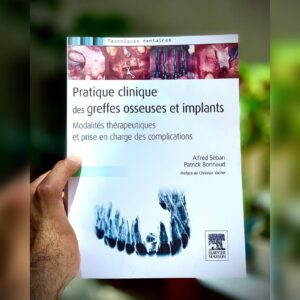 Pratique clinique des greffes osseuses et implants