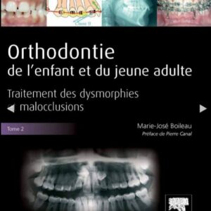 Orthodontie de l'enfant et du jeune adulte Tome 2 : Traitement des dysmorphies et malocclusions