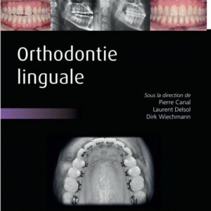 Orthodontie linguale