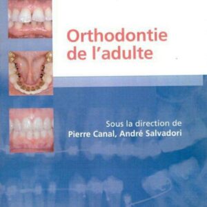 Orthodontie de l'adulte